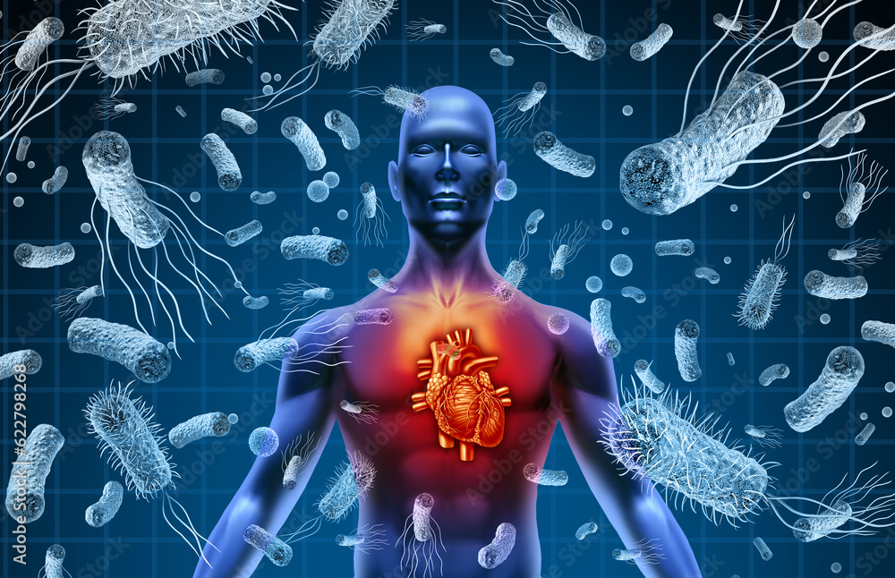 Sepsis
